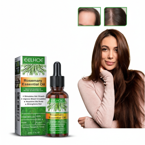 زيت إكليل الجبل للشعر (30ML) – لتحفيز النمو وتقوية البصيالت